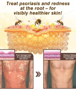 ๐๐ฏ๐จ๐๐ฏ๐จยฎ ๐๐๐ ๐๐๐ง๐จ๐ฆ & ๐๐๐ญ๐ฎ๐ซ๐๐ฅ ๐๐๐ฅ๐ฅ๐จ๐ฐ ๐๐ค๐ข๐ง ๐๐๐ฉ๐๐ข๐ซ ๐๐ซ๐๐๐ฆ