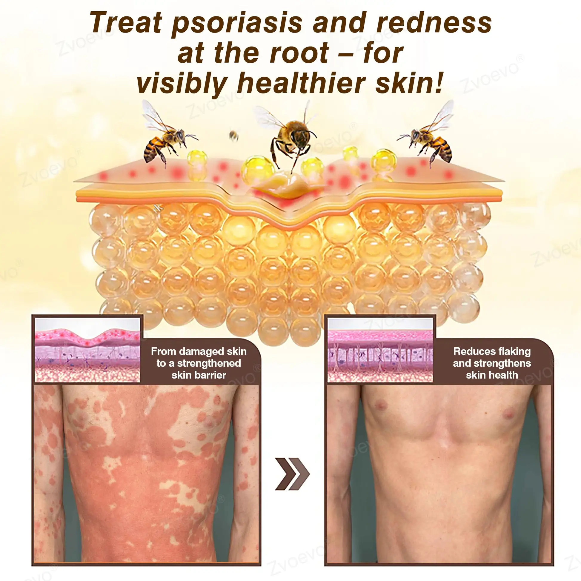 ๐๐ฏ๐จ๐๐ฏ๐จยฎ ๐๐๐ ๐๐๐ง๐จ๐ฆ & ๐๐๐ญ๐ฎ๐ซ๐๐ฅ ๐๐๐ฅ๐ฅ๐จ๐ฐ ๐๐ค๐ข๐ง ๐๐๐ฉ๐๐ข๐ซ ๐๐ซ๐๐๐ฆ