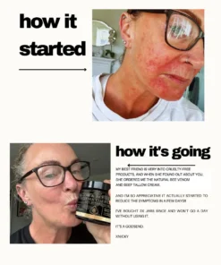 ๐๐ฏ๐จ๐๐ฏ๐จยฎ ๐๐๐ ๐๐๐ง๐จ๐ฆ & ๐๐๐ญ๐ฎ๐ซ๐๐ฅ ๐๐๐ฅ๐ฅ๐จ๐ฐ ๐๐ค๐ข๐ง ๐๐๐ฉ๐๐ข๐ซ ๐๐ซ๐๐๐ฆ