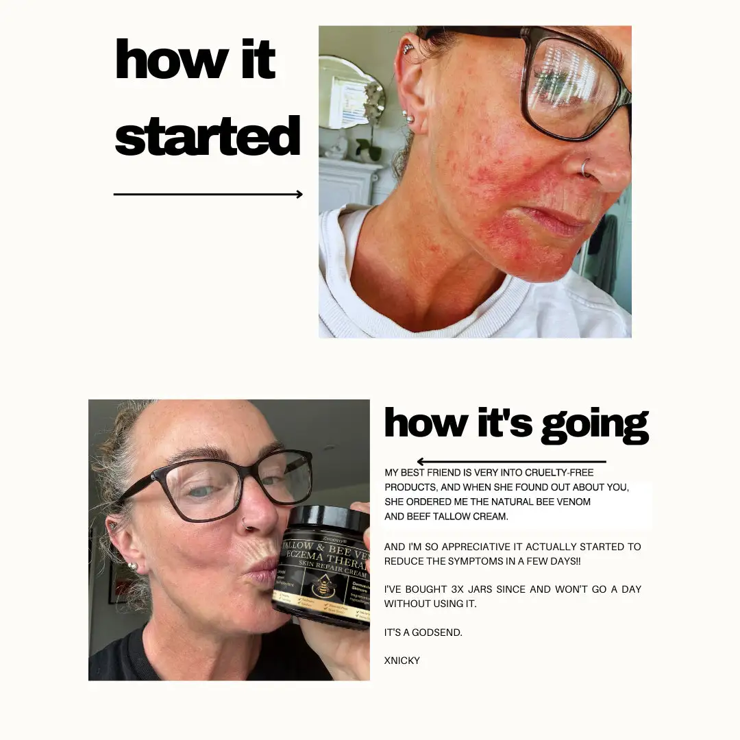 ๐๐ฏ๐จ๐๐ฏ๐จยฎ ๐๐๐ ๐๐๐ง๐จ๐ฆ & ๐๐๐ญ๐ฎ๐ซ๐๐ฅ ๐๐๐ฅ๐ฅ๐จ๐ฐ ๐๐ค๐ข๐ง ๐๐๐ฉ๐๐ข๐ซ ๐๐ซ๐๐๐ฆ