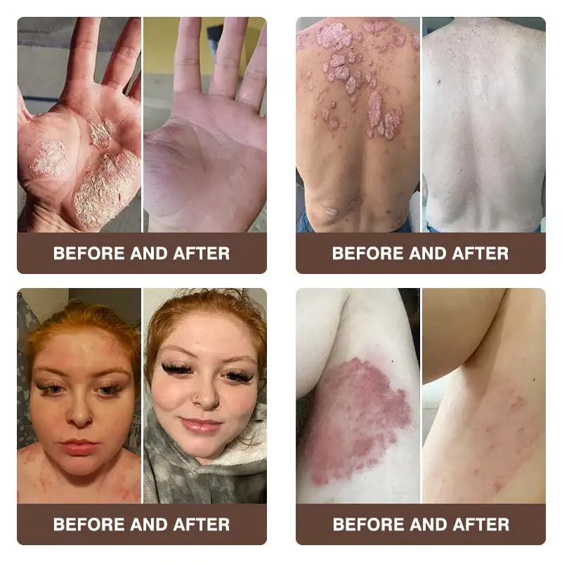 ๐๐ฏ๐จ๐๐ฏ๐จยฎ ๐๐๐ ๐๐๐ง๐จ๐ฆ & ๐๐๐ญ๐ฎ๐ซ๐๐ฅ ๐๐๐ฅ๐ฅ๐จ๐ฐ ๐๐ค๐ข๐ง ๐๐๐ฉ๐๐ข๐ซ ๐๐ซ๐๐๐ฆ