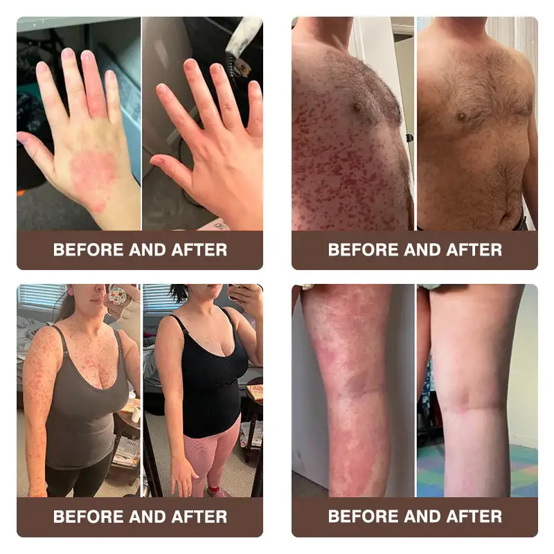 ๐๐ฏ๐จ๐๐ฏ๐จยฎ ๐๐๐ฅ๐ฅ๐จ๐ฐ & ๐๐๐ ๐๐๐ง๐จ๐ฆ ๐๐ฌ๐จ๐ซ๐ข๐๐ฌ๐ข๐ฌ & ๐๐๐ณ๐๐ฆ๐ ๐๐๐ฅ๐ข๐๐ ๐๐ซ๐๐๐ฆ