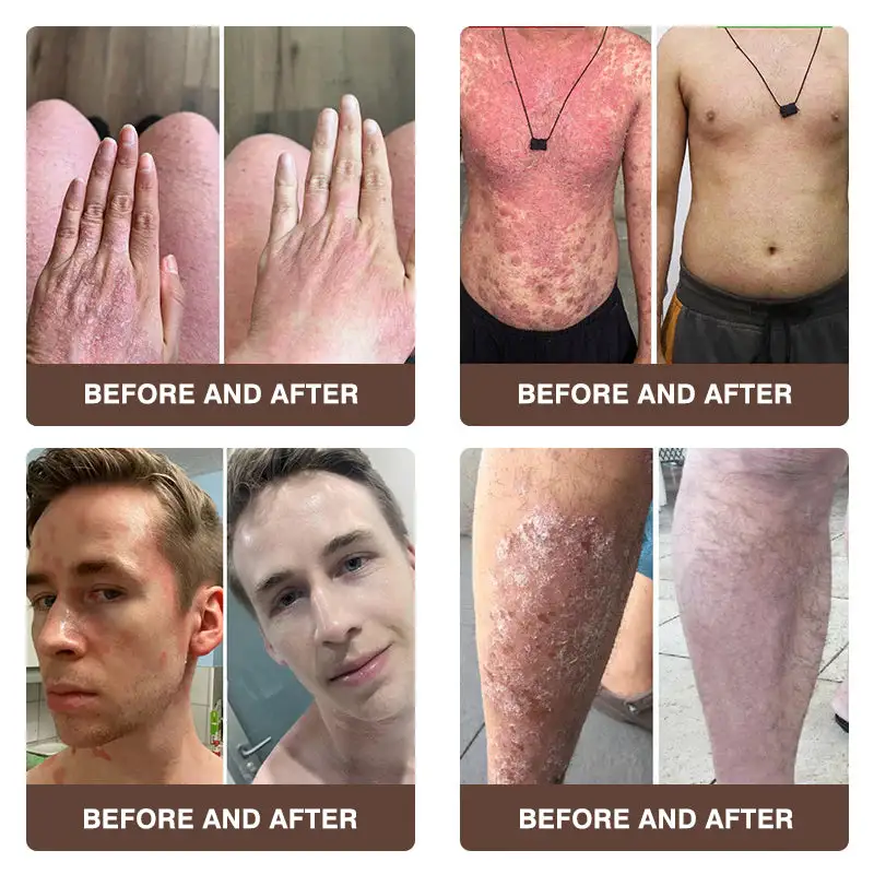 ๐๐ฏ๐จ๐๐ฏ๐จยฎ ๐๐๐ฅ๐ฅ๐จ๐ฐ & ๐๐๐ ๐๐๐ง๐จ๐ฆ ๐๐ฌ๐จ๐ซ๐ข๐๐ฌ๐ข๐ฌ & ๐๐๐ณ๐๐ฆ๐ ๐๐๐ฅ๐ข๐๐ ๐๐ซ๐๐๐ฆ