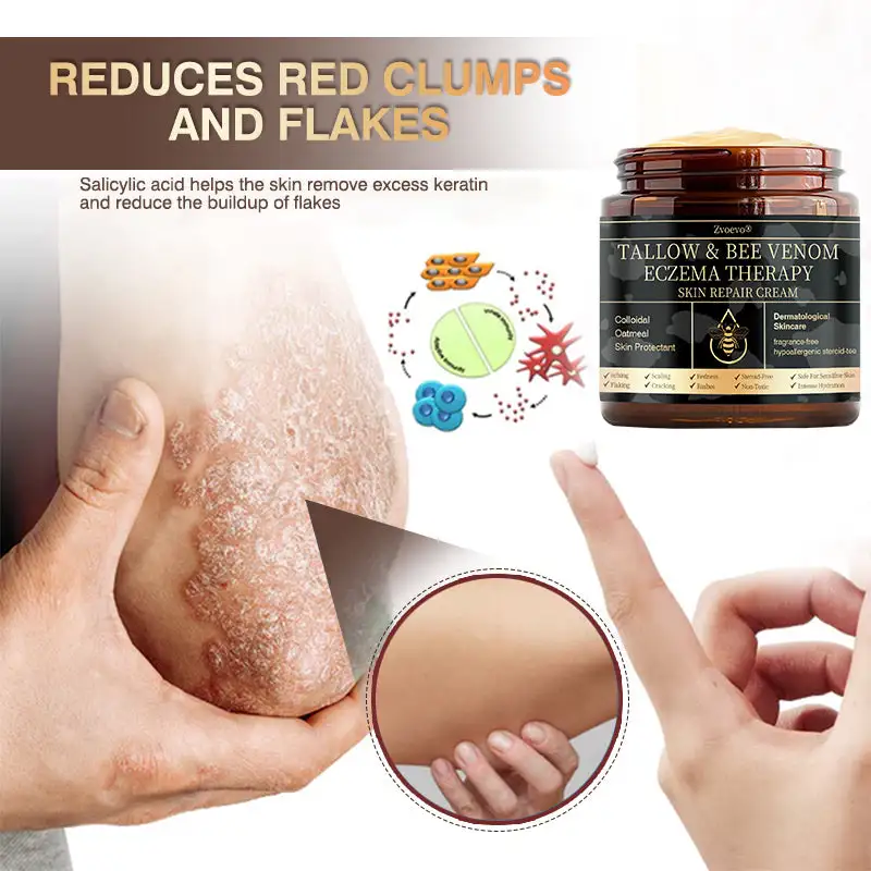 ๐๐ฏ๐จ๐๐ฏ๐จยฎ ๐๐๐ฅ๐ฅ๐จ๐ฐ & ๐๐๐ ๐๐๐ง๐จ๐ฆ ๐๐ฌ๐จ๐ซ๐ข๐๐ฌ๐ข๐ฌ & ๐๐๐ณ๐๐ฆ๐ ๐๐๐ฅ๐ข๐๐ ๐๐ซ๐๐๐ฆ