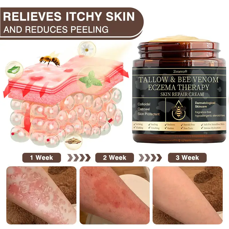 ๐๐ฏ๐จ๐๐ฏ๐จยฎ ๐๐๐ฅ๐ฅ๐จ๐ฐ & ๐๐๐ ๐๐๐ง๐จ๐ฆ ๐๐ฌ๐จ๐ซ๐ข๐๐ฌ๐ข๐ฌ & ๐๐๐ณ๐๐ฆ๐ ๐๐๐ฅ๐ข๐๐ ๐๐ซ๐๐๐ฆ