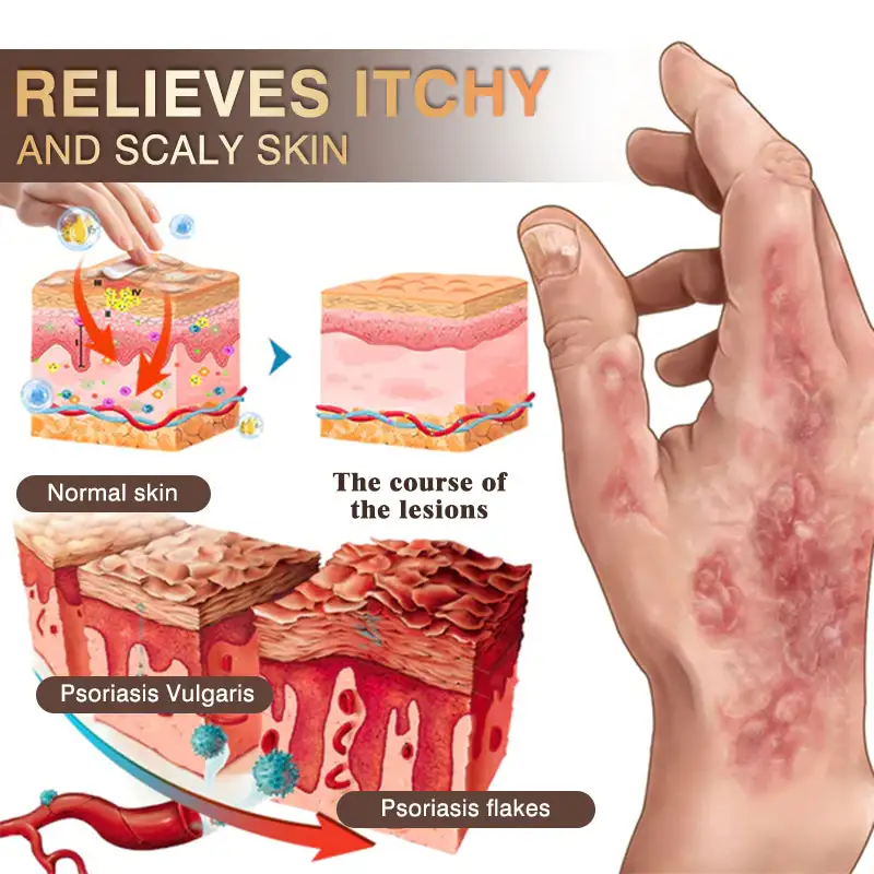 ๐๐ฏ๐จ๐๐ฏ๐จยฎ ๐๐ฌ๐จ๐ซ๐ข๐๐ฌ๐ข๐ฌ & ๐๐๐ณ๐๐ฆ๐ ๐๐๐ฅ๐ข๐๐ ๐๐ซ๐๐๐ฆ