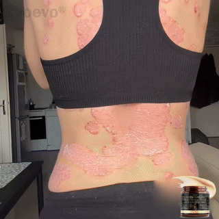 ๐๐ฏ๐จ๐๐ฏ๐จยฎ ๐๐ฌ๐จ๐ซ๐ข๐๐ฌ๐ข๐ฌ & ๐๐๐ณ๐๐ฆ๐ ๐๐๐ฅ๐ข๐๐ ๐๐ซ๐๐๐ฆ