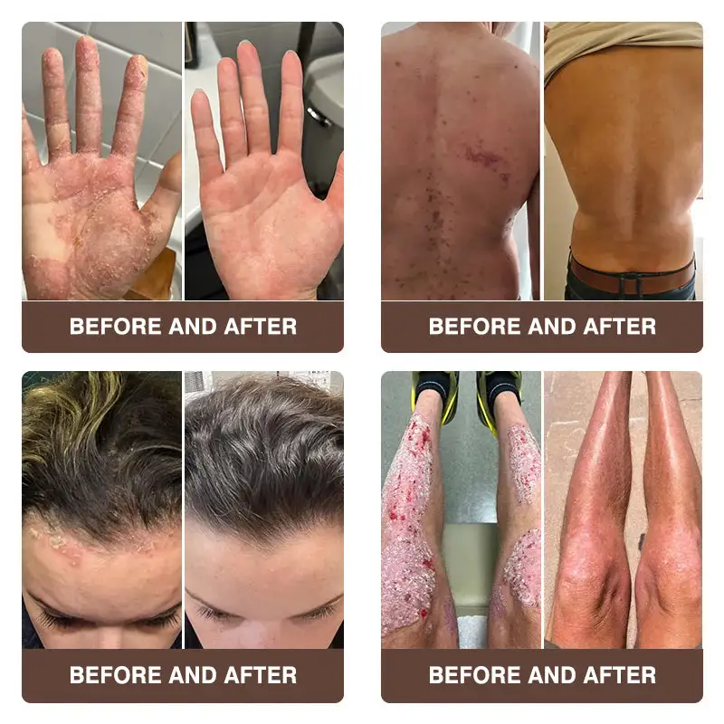 ๐๐ฏ๐จ๐๐ฏ๐จยฎ ๐๐ฌ๐จ๐ซ๐ข๐๐ฌ๐ข๐ฌ & ๐๐๐ณ๐๐ฆ๐ ๐๐๐ฅ๐ข๐๐ ๐๐ซ๐๐๐ฆ