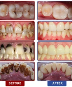 ๐๐ฏ๐จ๐๐ฏ๐จยฎ ๐๐ซ๐๐ฅ ๐๐๐ซ๐ ๐๐ข๐ช๐ฎ๐ข๐