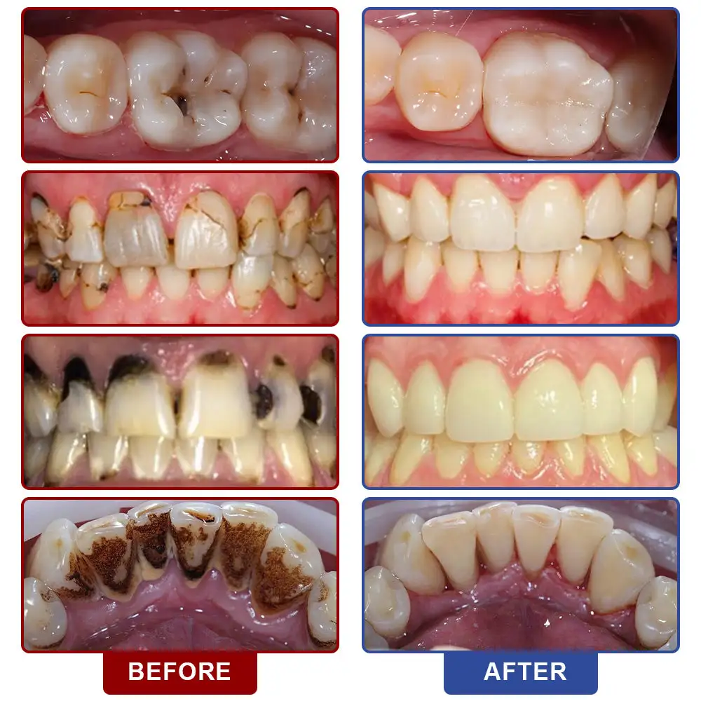 ๐๐ฏ๐จ๐๐ฏ๐จยฎ ๐๐ซ๐๐ฅ ๐๐๐ซ๐ ๐๐ข๐ช๐ฎ๐ข๐