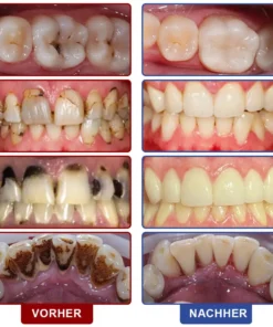 ๐๐ฏ๐จ๐๐ฏ๐จยฎ ๐๐๐ก๐ง๐ฌ๐๐ก๐ฎ๐ญ๐ณ & ๐๐๐ก๐ง๐ซ๐๐ ๐๐ง๐๐ซ๐๐ญ๐ข๐จ๐ง ๐
๐ฅรผ๐ฌ๐ฌ๐ข๐ ๐ค๐๐ข๐ญ