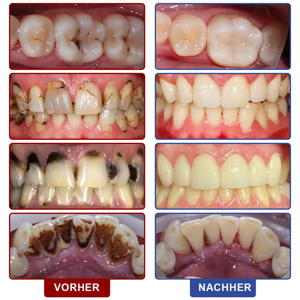 ๐๐ฏ๐จ๐๐ฏ๐จยฎ ๐๐๐ก๐ง๐ฌ๐๐ก๐ฎ๐ญ๐ณ & ๐๐๐ก๐ง๐ซ๐๐ ๐๐ง๐๐ซ๐๐ญ๐ข๐จ๐ง ๐
๐ฅรผ๐ฌ๐ฌ๐ข๐ ๐ค๐๐ข๐ญ