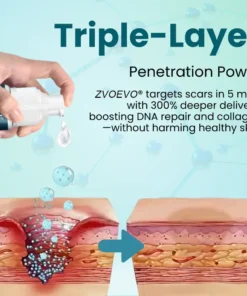 Zvoevo® Advanced Scar Gel for Surgical Scars