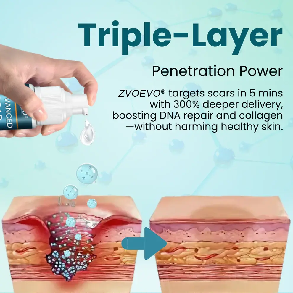 Zvoevo® Advanced Scar Gel for Surgical Scars
