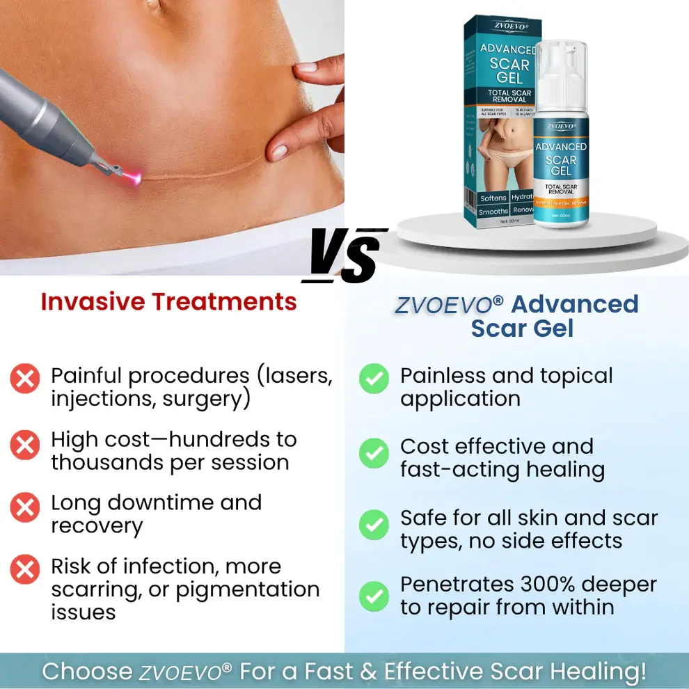Zvoevo® Advanced Scar Gel for Surgical Scars