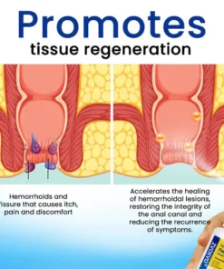 Zvoevo® Herbal Hemorrhoids Fast-Acting Treatment Spray