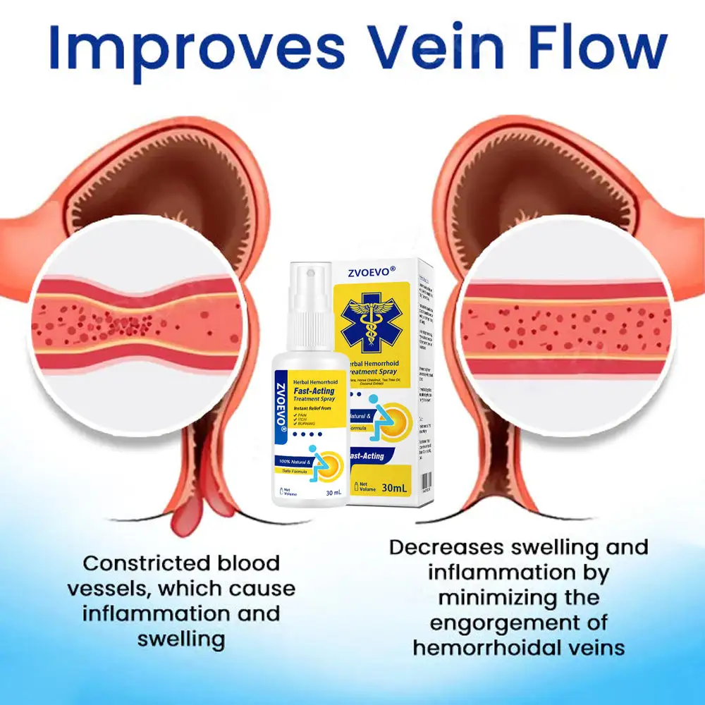 Zvoevo® Herbal Hemorrhoids Fast-Acting Treatment Spray