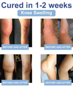 Zvoevo® Magnesium Pain Healing Bone Cream