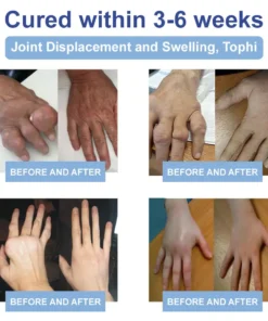 Zvoevo® Magnesium Pain Healing Bone Cream