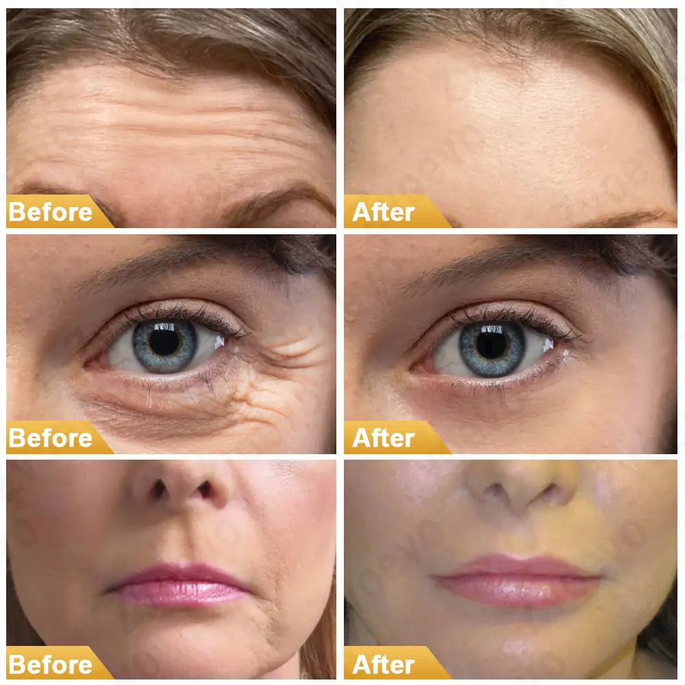 Zvoevo® Snail Colleagen Face Cream