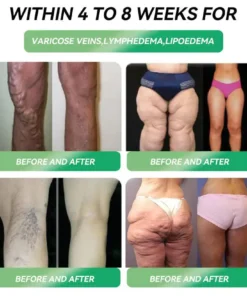 𝑍𝑣𝑜𝑒𝑣𝑜® 𝐺𝐿𝑃-𝟏 𝑺𝑰𝑿-𝑰𝑵-𝑶𝑵𝑬 𝑯𝒆𝒂𝒍𝒕𝒉 𝑺𝒐𝒍𝒖𝒕𝒊𝒐𝒏 𝑶𝒓𝒂𝒍 𝑳𝒊𝒒𝒖𝒊𝒅