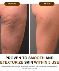 𝐙𝐯𝐨𝐞𝐯𝐨® 𝐒𝐢𝐥𝐤 𝐁𝐨𝐝𝐲 𝐎𝐢𝐥