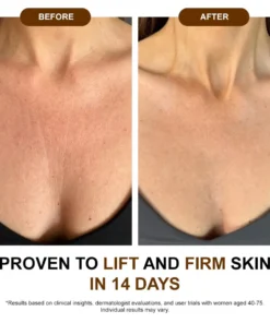 𝐙𝐯𝐨𝐞𝐯𝐨® 𝐒𝐢𝐥𝐤 𝐁𝐨𝐝𝐲 𝐎𝐢𝐥