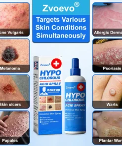 𝐙𝐯𝐨𝐞𝐯𝐨® 𝐇𝐲𝐩𝐨𝐜𝐡𝐥𝐨𝐫𝐨𝐮𝐬 𝐀𝐜𝐢𝐝 𝐒𝐩𝐫𝐚𝐲