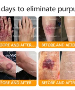 Zvoevo® Bee Venom Skin Restoration Cream