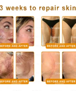 Zvoevo® Bee Venom Skin Restoration Cream