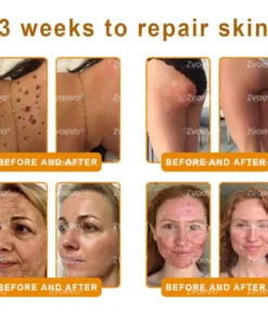 Zvoevo® Bee Venom Skin Restoration Cream