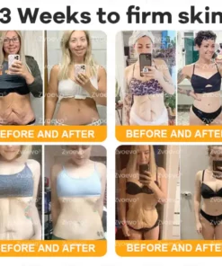 Zvoevo® Bee Venom Skin Restoration Cream