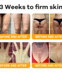 Zvoevo® Bee Venom Skin Restoration Cream