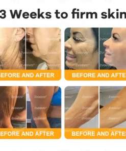 Zvoevo® Bee Venom Skin Restoration Cream