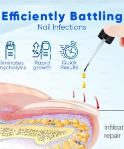 Zvoevo® OnyxoGuard Nail Growth and Repair Serum