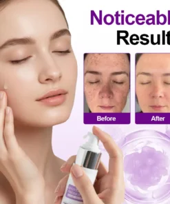 𝐳𝐯𝐨𝐞𝐯𝐨® 𝐒𝐩𝐨𝐭𝐄𝐫𝐚𝐬𝐞 𝐏𝐫𝐨𝐛𝐢𝐨𝐭𝐢𝐜 𝐒𝐡𝐢𝐞𝐥𝐝 𝐒𝐞𝐫𝐮𝐦