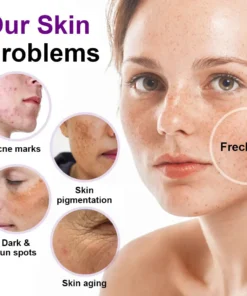 𝐳𝐯𝐨𝐞𝐯𝐨® 𝐒𝐩𝐨𝐭𝐄𝐫𝐚𝐬𝐞 𝐏𝐫𝐨𝐛𝐢𝐨𝐭𝐢𝐜 𝐒𝐡𝐢𝐞𝐥𝐝 𝐒𝐞𝐫𝐮𝐦