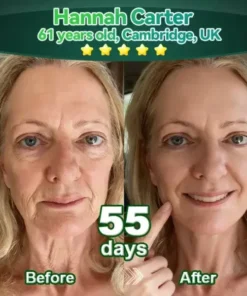 Zvoevo®𝐒𝐭𝐞𝐦 𝐂𝐞𝐥𝐥 & 𝐂𝐨𝐥𝐥𝐚𝐠𝐞𝐧 𝐏𝐞𝐩𝐭𝐢𝐝𝐞 𝐎𝐫𝐚𝐥 𝐃𝐫𝐨𝐩𝐬