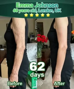 Zvoevo®𝐒𝐭𝐞𝐦 𝐂𝐞𝐥𝐥 & 𝐂𝐨𝐥𝐥𝐚𝐠𝐞𝐧 𝐏𝐞𝐩𝐭𝐢𝐝𝐞 𝐎𝐫𝐚𝐥 𝐃𝐫𝐨𝐩𝐬